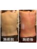 期間限定！ダイエットコース　3種組み合わせ自由約80分　　10000円