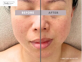 ビューティー ブロッサム(Beauty Blossom)/