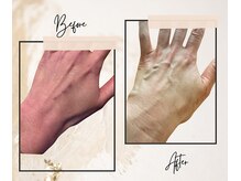 ラネージュ(LA NEIGE)/【札幌LA NEIGE】美/ヒト幹細胞