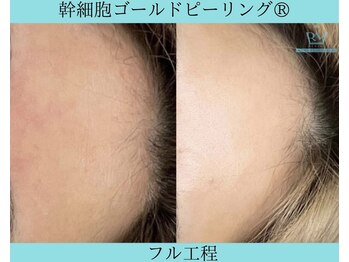 リメイククリニカルビューティー(Remake clinical beauty)/