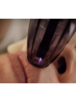 毛穴ケアをしたい