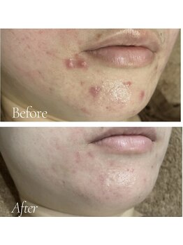 スリリアン 銀座/★お客さまビフォーアフター★