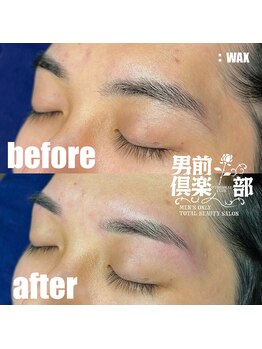 男前倶楽部/脱毛/メンズ脱毛/メンズ専門店