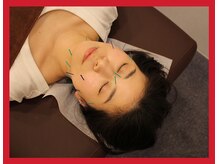 【美容鍼・ダイエット】メリとハリ　阿倍野店の雰囲気（[整体/鍼灸/美容鍼/首肩こり/頭痛/腰痛/眼精疲労/小顔/むくみ]）