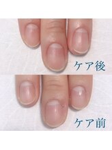 アレス 狛江店(ales)/美爪ケアコース