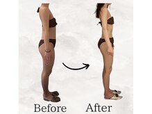 レナータ バイ アフロスクィーン(Renata by Aphros Queen)/Before&After