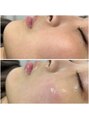 アイラッシュ ミル 御領店(eye lash Miru) お肌の悩みを解決に導きます!