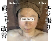 エステサロン シュール/ハイパーナイフフェイシャル