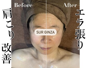 エステサロン シュール/ハイパーナイフフェイシャル