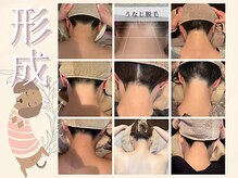 リリス(LILISS)の雰囲気（うなじや背中脱毛で印象は変化します。つるつる美人うなじへ◇。）