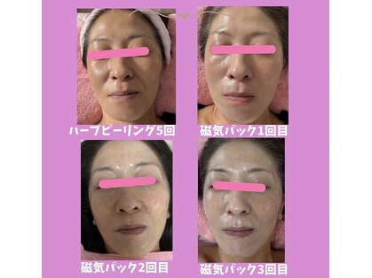 サロン ほほえむ(Fofo-m)の写真