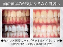 ホワイトニングビューティー 金沢駅前店(WHITENING BEAUTY)