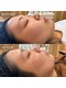 美整庵 谷山店(BISEIAN)の写真/ツヤツヤ タマゴ肌♪クリスティーナ BIOPHYTO ハーブピーリング。信頼と実績の肌質改善メニューで美肌へ