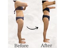 レナータ バイ アフロスクィーン(Renata by Aphros Queen)/Before&After