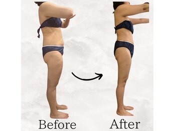 レナータ バイ アフロスクィーン(Renata by Aphros Queen)/Before&After