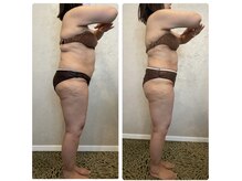 サロン ド フェイス モアナ(Salon de Faith Moana)/キャビテーション痩身