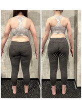 ミスプロ(M'spro)/2ヶ月間ビフォーアフター3