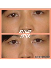 練馬アカデミア美容整体院/小顔　小顔矯正　美容整体　整体