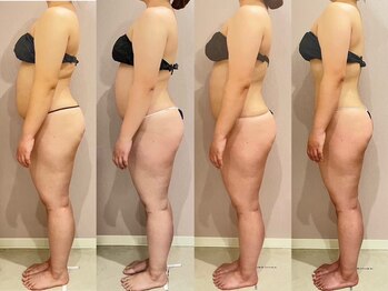 スローティ ラテ 旭川店/気になる部位もお任せください!