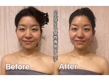ゴールドハンド 溝の口店(Gold Hand)/Goldhand小顔矯正1回結果出し
