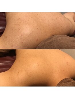 サロンリーナ 銀座店(SalonLena)/グリーンピールBODY