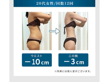 シュリット(Schritt.)の写真