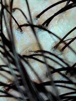 ジジ(jiji)/皮脂や汗、汚れが詰まった頭皮