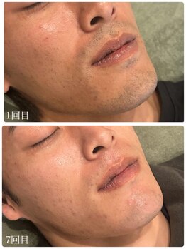 クラン 森ノ宮店(Clan)/20代、男性