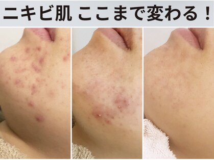 アイビーケア 三田(ivy care)の写真