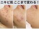 アイビーケア 三田(ivy care)の写真
