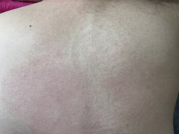 ホームプラスワクシング(Home＋waxing)/背中の毛！見たことありますか？