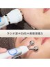 【リフトUPケア】シワ・たるみ改善ラジオ波・EMS＋美容液導入￥8,900→