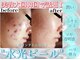 ホワイトアクア 三ノ宮店(WHITE AQUA)の写真