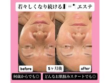 ディサイドロー(DECIDE L.A.W)の雰囲気（30代～60代にも人気！効果のでる施術と居心地の良い空間♪）