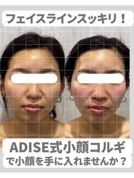 アディス 心斎橋(ADISE)/ADISE式コルギで輪郭すっきり！