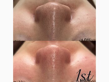 ファースト(1st)/