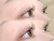 セレクト アイコンシェルジュ 新宿店(SELECT eye concierge)の写真