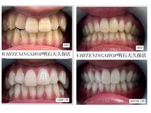 1来店で3～6トーンアップ。一人一人に合ったプランをご案内♪
