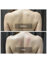 アンフェム(Anfem)/オイルリンパビフォアフ2