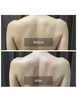 アンフェム(Anfem)/オイルリンパビフォアフ2