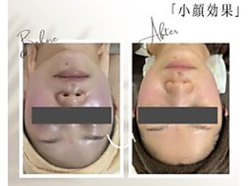 肌イズム つくば店(肌ism)