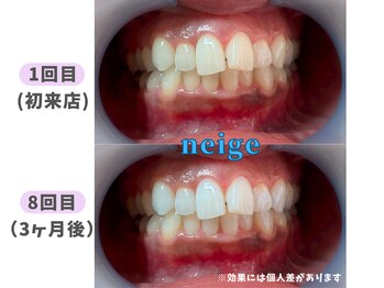 ネージュ(neige)/30代後半/女性/コーヒー1日1杯