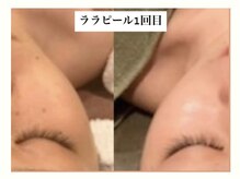 ビジュー(BIJOU)/