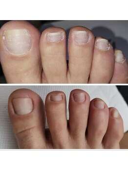 アイネイル 高幡不動(Ai Nail)/フットケア