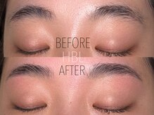 パール(PEAR+L)/ハリウッドブロウリフト