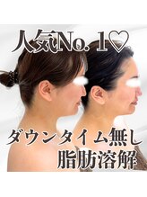 ミタメ 銀座店(MITAME)/人気No. 1♪脂肪燃解