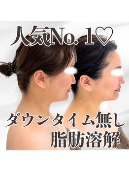 ミタメ 銀座店(MITAME)/人気No. 1♪脂肪燃解
