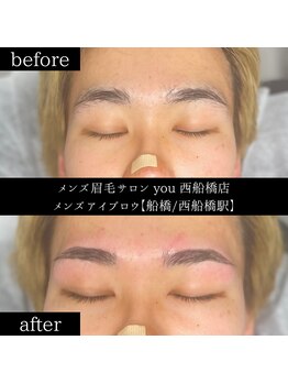 ユー 西船橋店(you)/ビフォーアフター写真