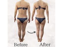 レナータ バイ アフロスクィーン(Renata by Aphros Queen)/Before&After