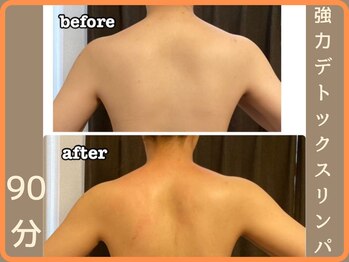 ニース(NICE)/30代/女性/施術1回